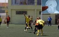 يلعب مباراة كاملة وبرأسه رصاصة