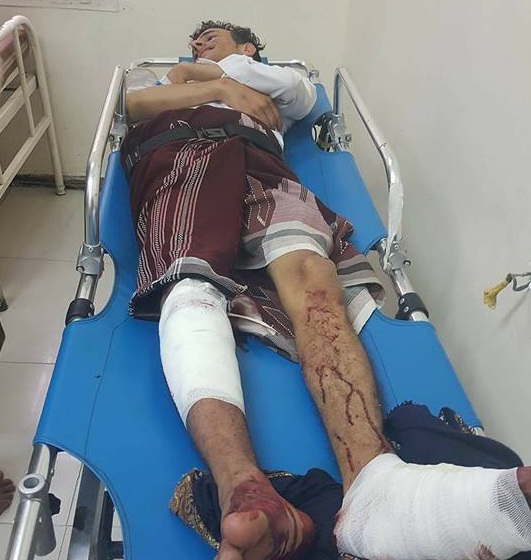 اصابة المرافق الخاص لوكيل محافظ تعز اثر اطلاق النار عليه