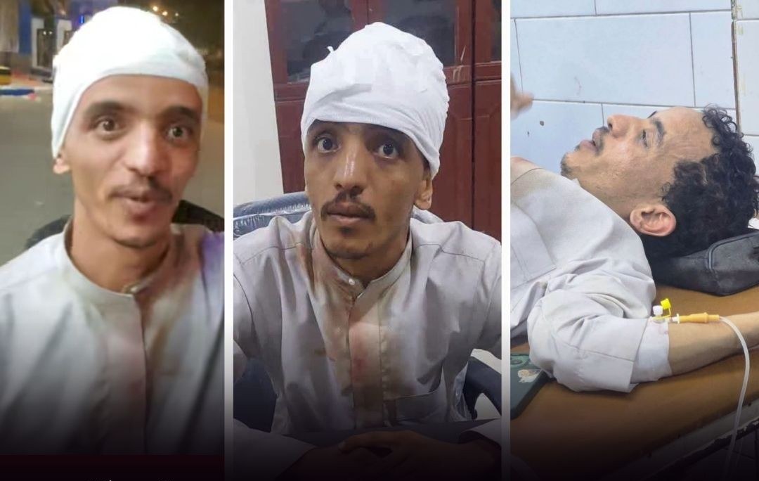التوجس القاتل.. حماسة بافضل تقوده من حضرموت إلى فعالية للانتقالي في عدن فيعود مصاباً بـ"أحجار صديقة"