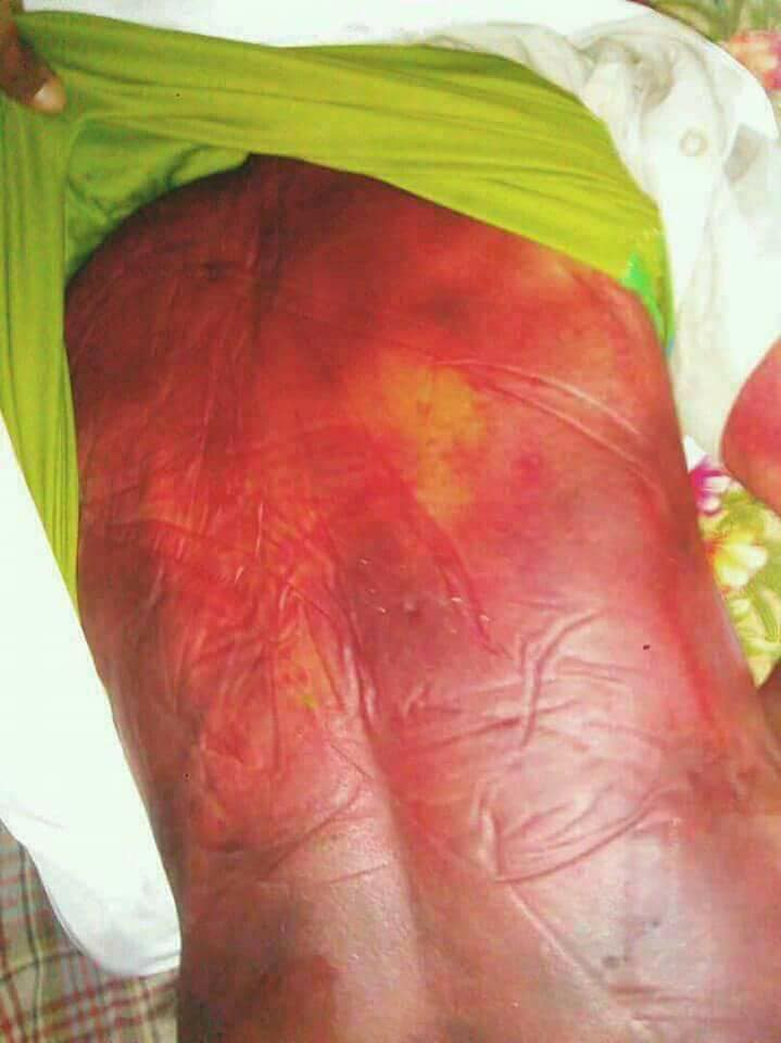 An abductee died in Houthis prison under brutal torture in al Dali