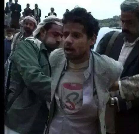 ما حقيقة ما تردد عن إعدام الحوثيين لأحد الأشخاص خارج نطاق القانون في عمران؟ (موسّع)