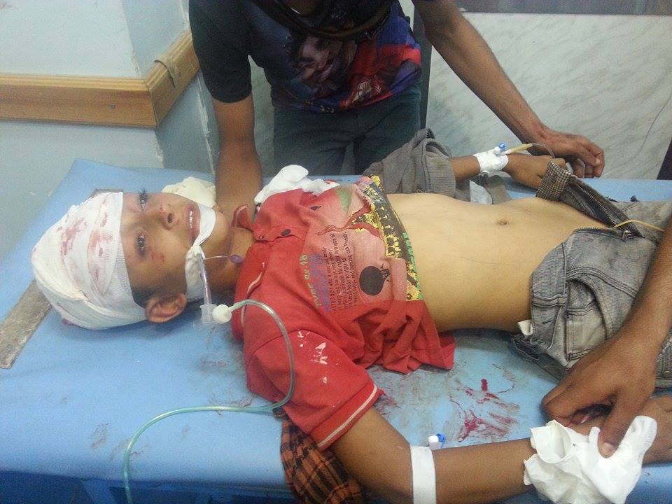 تقرير إنساني: الحرب في تعز خلفت خلال الشهرين الماضيين 324 يتيماً 