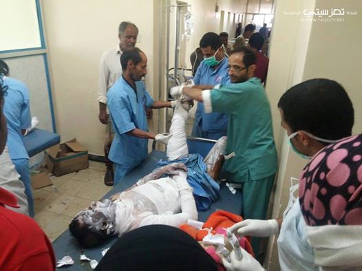 بلاغ من مجلس تنسيق المقاومة الشعبية بتعز حول حادثة احتراق ناقلة نفط خلفت قتلى وجرحى