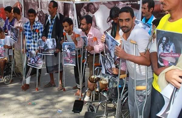 150Taiz Popular Resistance wounded to fly to Turkey for treatment