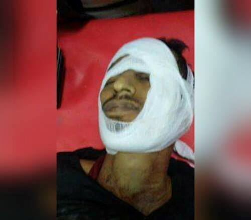  Houthi gunmen kill a civilian, kidnap another in Ibb city 