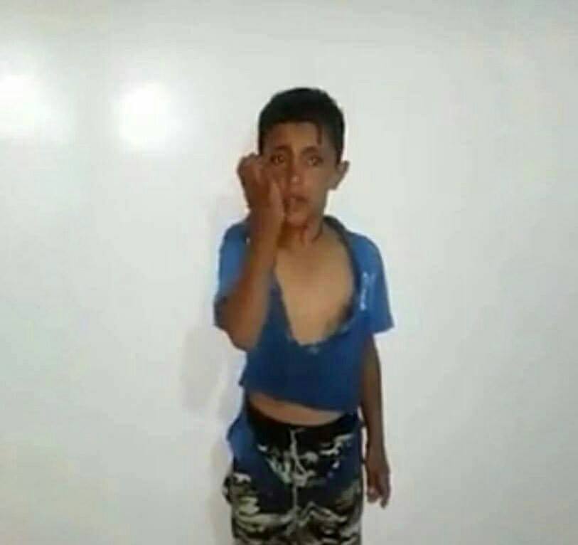 الحوثيون يفرجون عن طفل في ذي ناعم بالبيضاء بعد ساعات من خطفه وتعذيبه