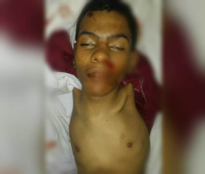 Taiz: Houthi sniper kills disabled child, shelling continues
