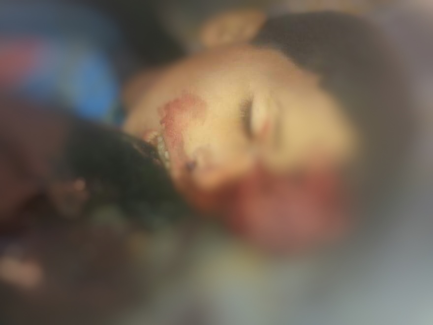 مقتل طفل بنيران الحوثيين استهدفت طلاب رفضوا «الصرخة» في محافظة ذمار