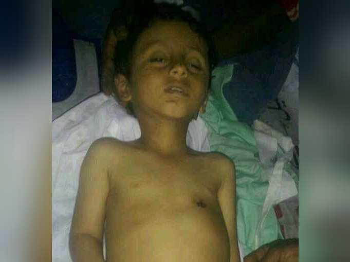مقتل طفل بإطلاق نار في أحد الأعراس في إب