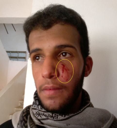 حوثيون يختطفون مراسلاً تلفزيونياً ويعتدون بالضرب المبرح على شبان وخطيب مسجد في صعدة