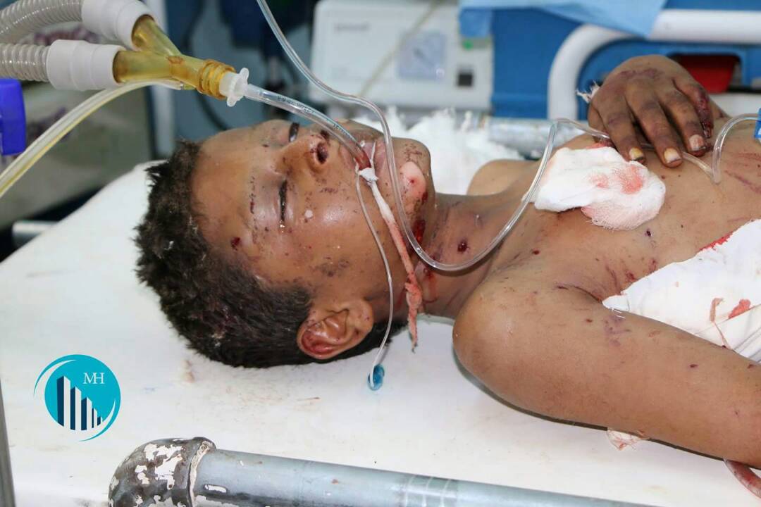 اليونيسف: مقتل 38 طفلاً وإصابة 19 آخرين خلال شهرين في اليمن