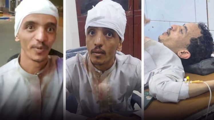 التوجس القاتل.. حماسة بافضل تقوده من حضرموت إلى فعالية للانتقالي في عدن فيعود مصاباً بـ"أحجار صديقة"