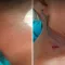 إصابة طفلة برصاص قناص حوثي غربي تعز