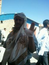 عناصر من شرطة النجدة تعتدي على مواطن في إب