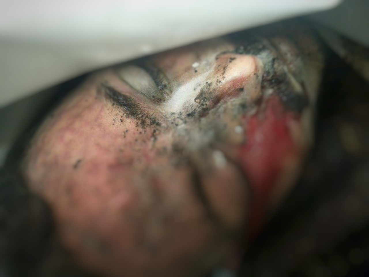 Dhamar: a third person dies under Houthis torture in prison