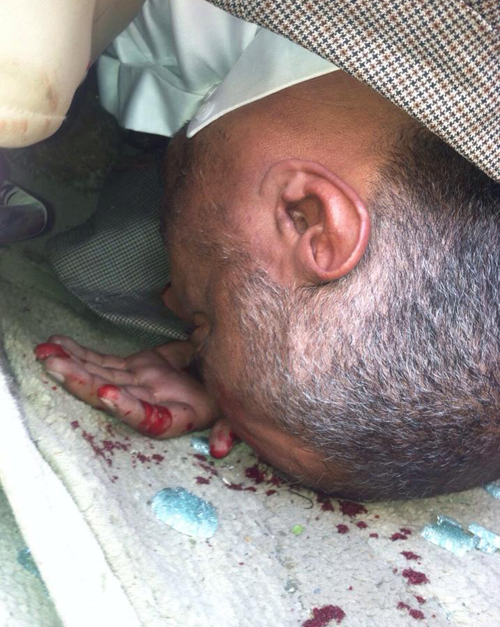 اغتيال الأمين العام المساعد لحزب الإصلاح في تعز بعبوة ناسفة استهدفت سيارته (صورة)