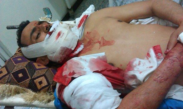عصابة مسلحة تسطو على متجر في إب وتصيب أحد عماله عصابة مسلحة تسطو على متجر في إب وتصيب أحد عماله