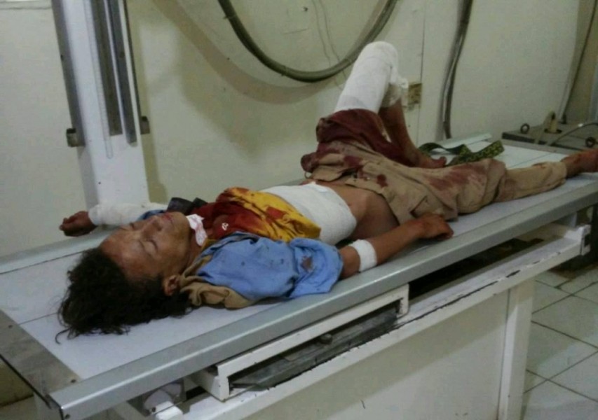 إصابة طفلين اثر قصف الحوثيين قرية في مريس بالضالع